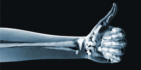 Xray of arm with hand doing thumbs up