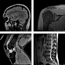 MRI Scan examples